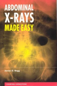 Image of Abdominal x-rays made easy