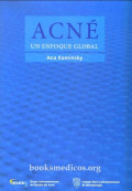Acné : un enfoque global