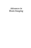 Advances in brain imaging