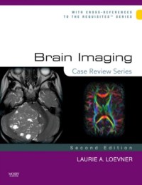 Image of Brain imaging : case review