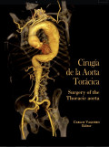 Cirugía de la aorta torácica = Surgery of the Thoracic aorta