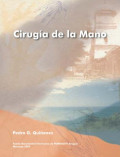 Ciruguia de la mano