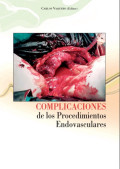 Complicaciones de los procedimientos endovasculares