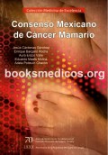Consenso mexicano de cáncer mamario