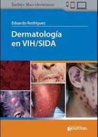 Image of Dermatología en VIH/SIDA