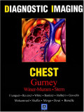 Diagnostic imaging : chest