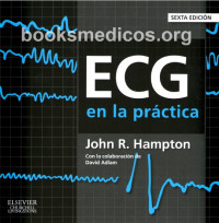 Image of ECG en la práctica