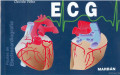 ECG : pautas de electrocardiografía