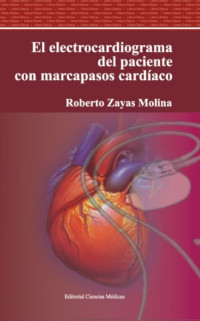 Image of El Electrocardiograma del paciente con marcapasos cardíaco