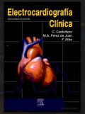 Electrocardiografía clínica