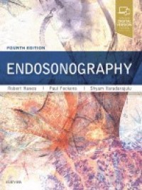 Image of Endosonography
