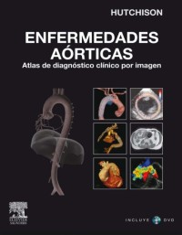 Image of Enfermedades aórticas : atlas de diagnóstico clínico por imagen