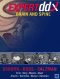 Expertddx : brain and spine