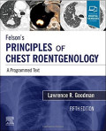 Felson’s. Principles of Chest roentgenology : a programmed text