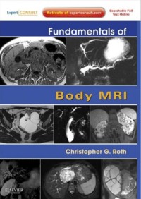 Image of Fundamentals of body MRI.