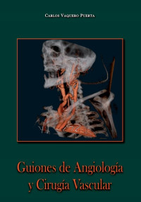 Image of Guiones de angiología y cirugía vascular