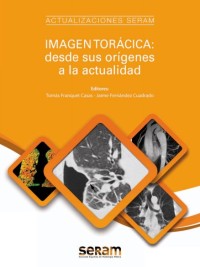 Image of Imagen torácica: desde sus orígenes a la actualidad