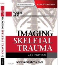 Image of Imaging skeletal trauma