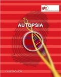 La Autopsia