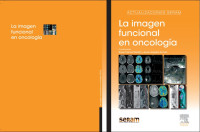 Image of La imagen funcional en oncología