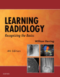 Learning radiology : recognizing the basics