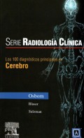 Los 100 diagnósticos principales en cerebro