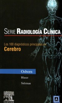 Image of Los 100 diagnósticos principales en cerebro