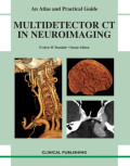Multidetector CT in neuroimaging : an atlas and practical guide