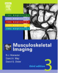 Musculoskeletal imaging
