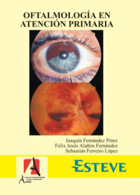 Image of Oftalmología en atención primaria