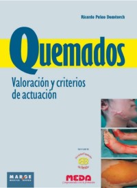 Image of Quemados : valoración y criterios de actuación