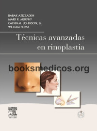 Image of Técnicas avanzadas en rinoplastia