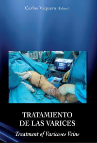 Image of Tratamiendo de las varices = Treatment of varicoses veins
