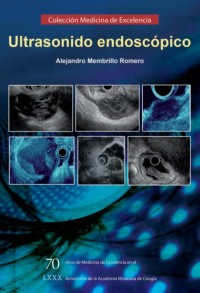 Image of Ultrasonido endoscópico